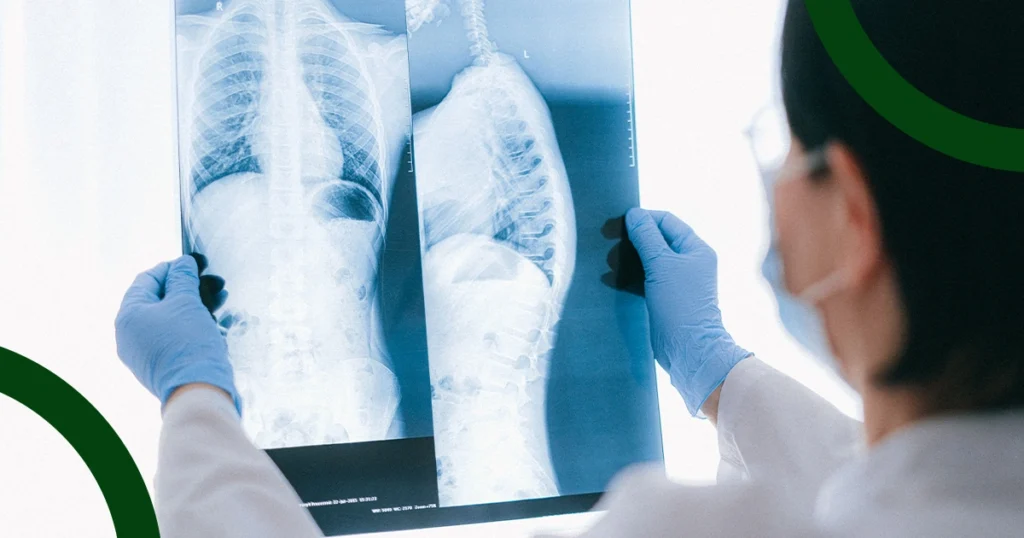 Lung Repair